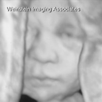 3D ultrasound - Weinstein Imaging Associates